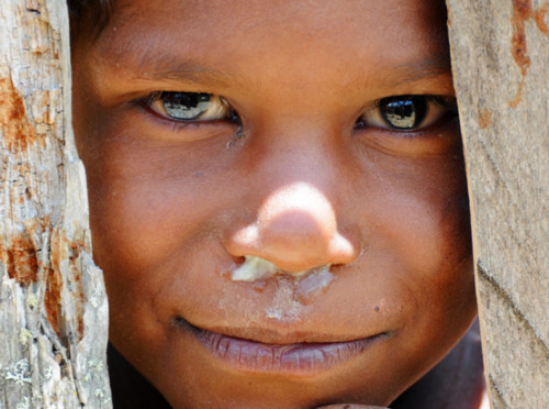 West Papua Sugapa Snot