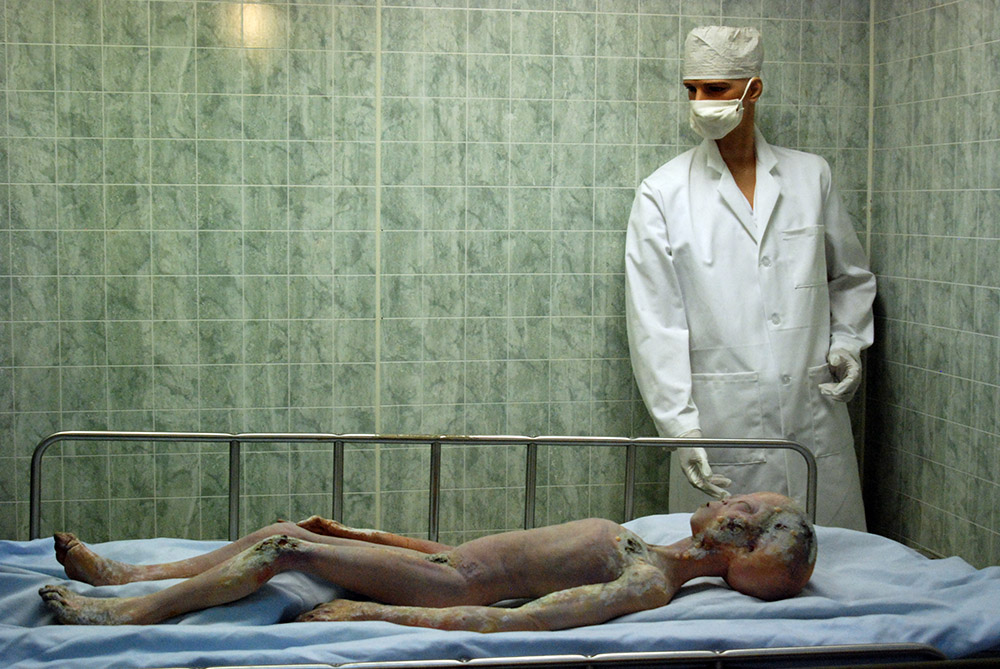 Alien Autopsy Alien autopsy exhibit at the Roswell UFO Museum